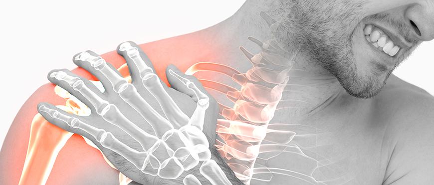 Tratamiento de fractura de hombro